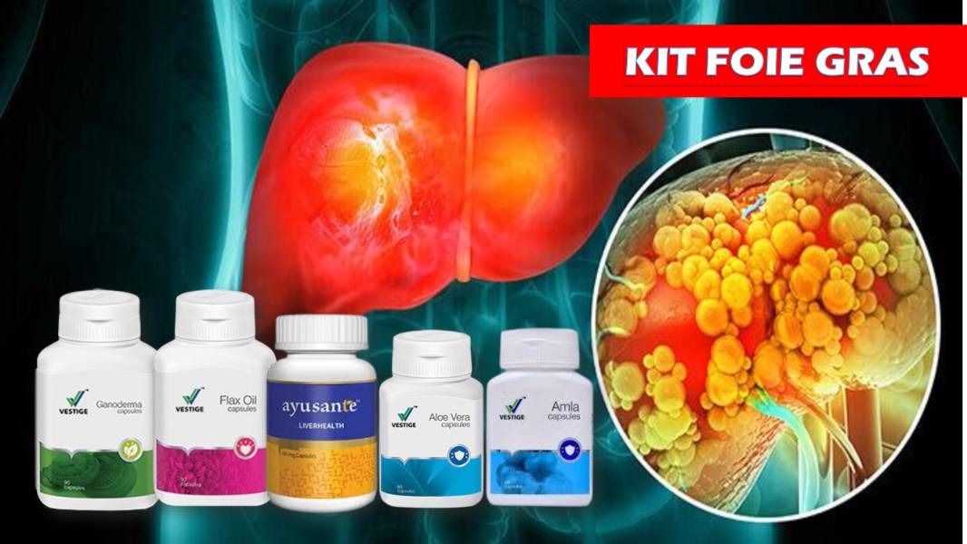Kit foie gras